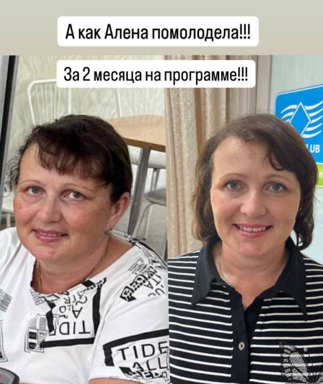 История: 47-й день: прошли отёки, мучившие больше года